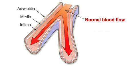 normal blood flow